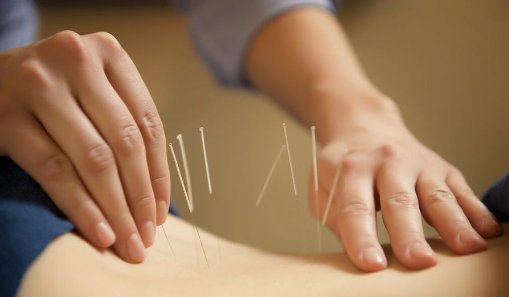 Acupuncture is a common way to treat chronic prostatitis